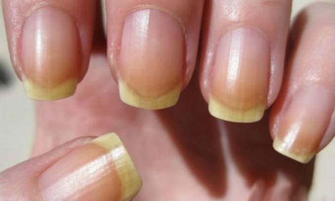 Unhas amarelas nunca mais (Foto: Reprodução)